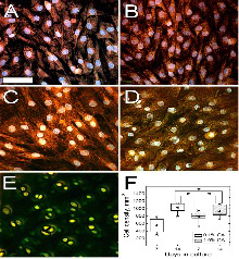 Confocal images of chondrocytes stained with DAPI